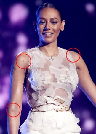 Bertengkar Hebat, Mel B Berpisah dari Suami